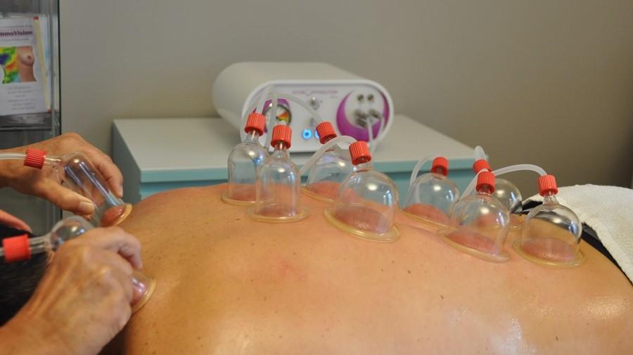 cupping massage cupping massage